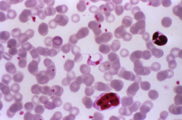 The parasite that causes Chagas disease